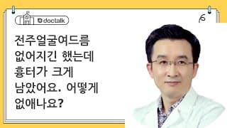 전주얼굴여드름 없어지긴 했는데 흉터가 크게 남았어요. 어떻게 없애나요?